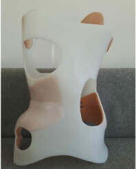 Digitalna fabrikacija u medicini pri izdradi Cheneau ortozama za ledja